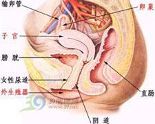 盆腔淤血症最新治疗法